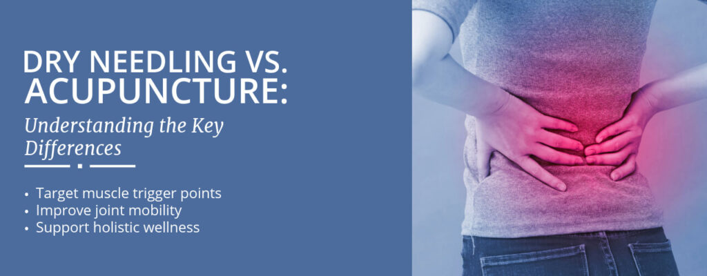 Dry Needling vs. Acupuncture: Understanding the Key Differences
